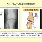 膝関節とカルシウム イメージ