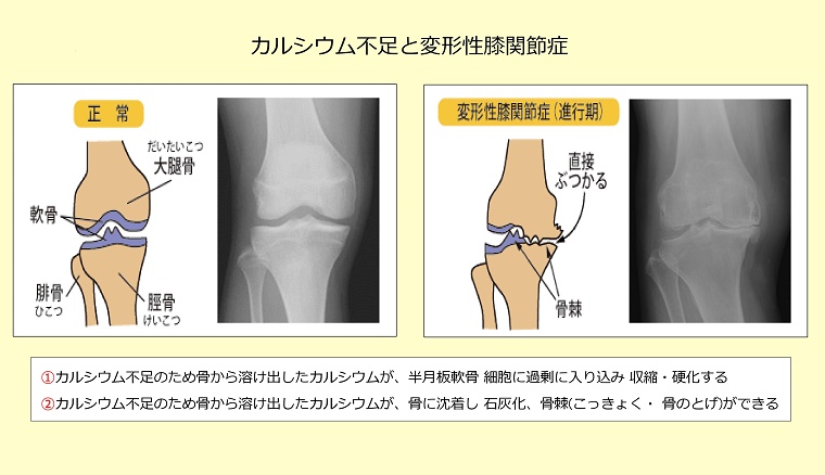膝関節とカルシウム イメージ